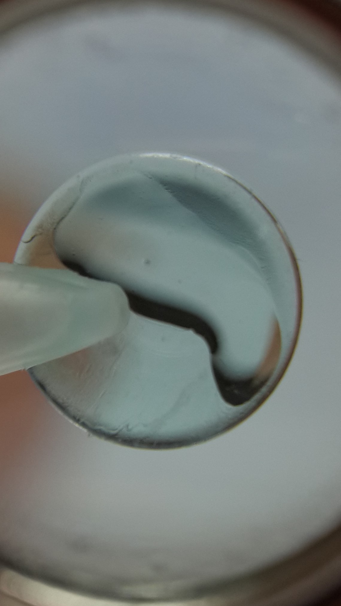 Gas Permeable Contact Lens Vantage Vision Care Optometrist