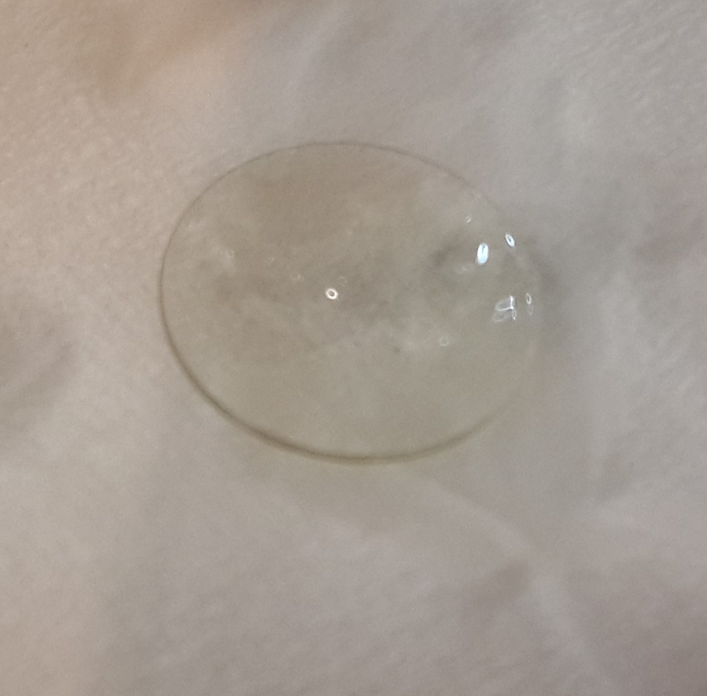 Gas Permeable Contact Lens Vantage Vision Care Optometrist